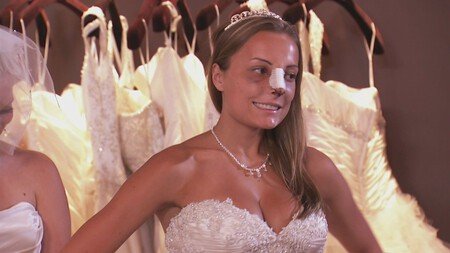 Bridalplasty